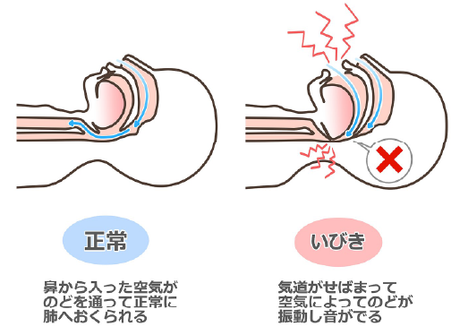 いびきの原因は？