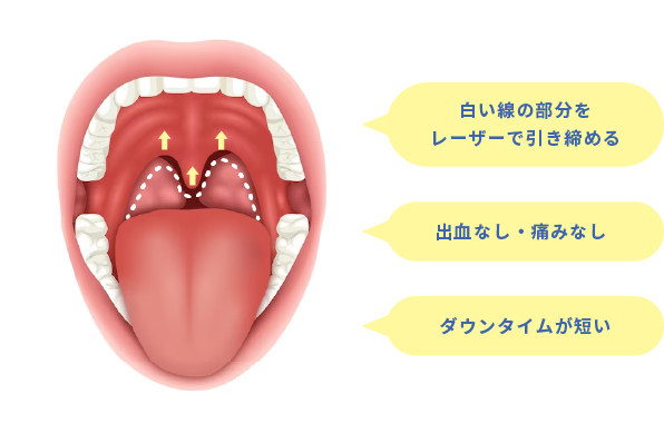 S3ブルーレーザーの特徴