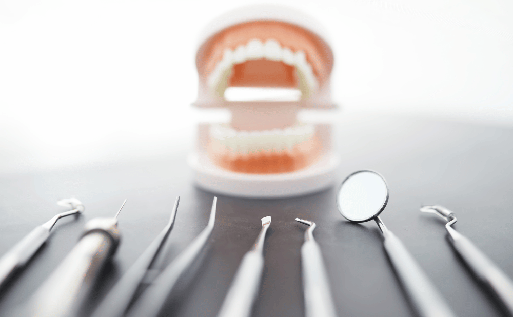 オールオンフォー治療で費用に差が出るポイント