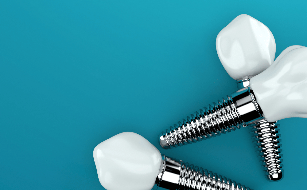 インプラントのダウンタイムはどれくらい？痛み・腫れ・日常生活の目安をわかりやすく解説