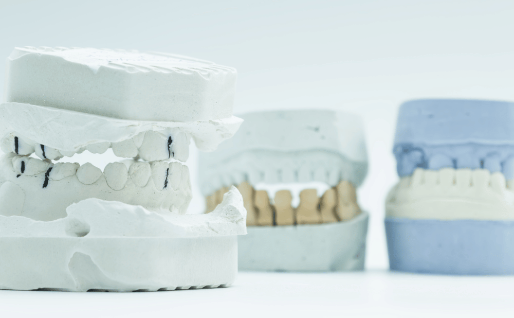 金山で受けられる歯列矯正の種類