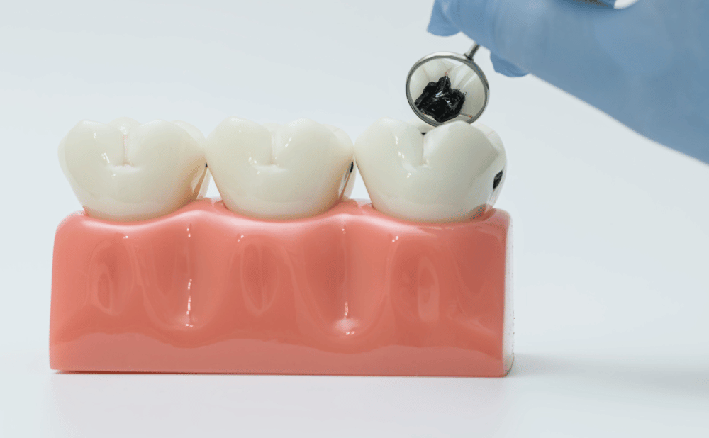 インビザラインは食事のとき外さないといけない？