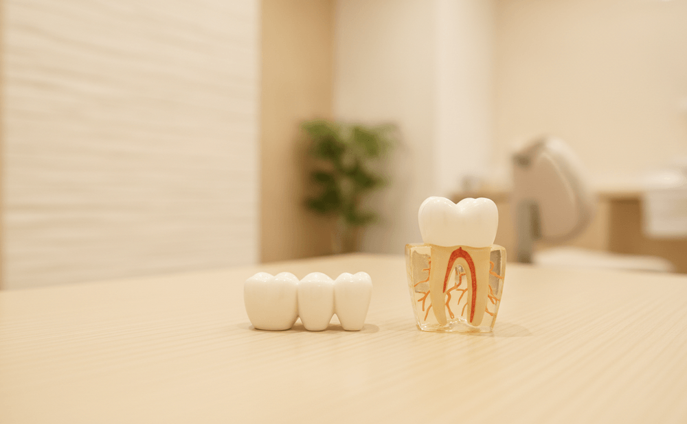 作り直せる差し歯と、抜歯を含めて考える差し歯の分かれ目